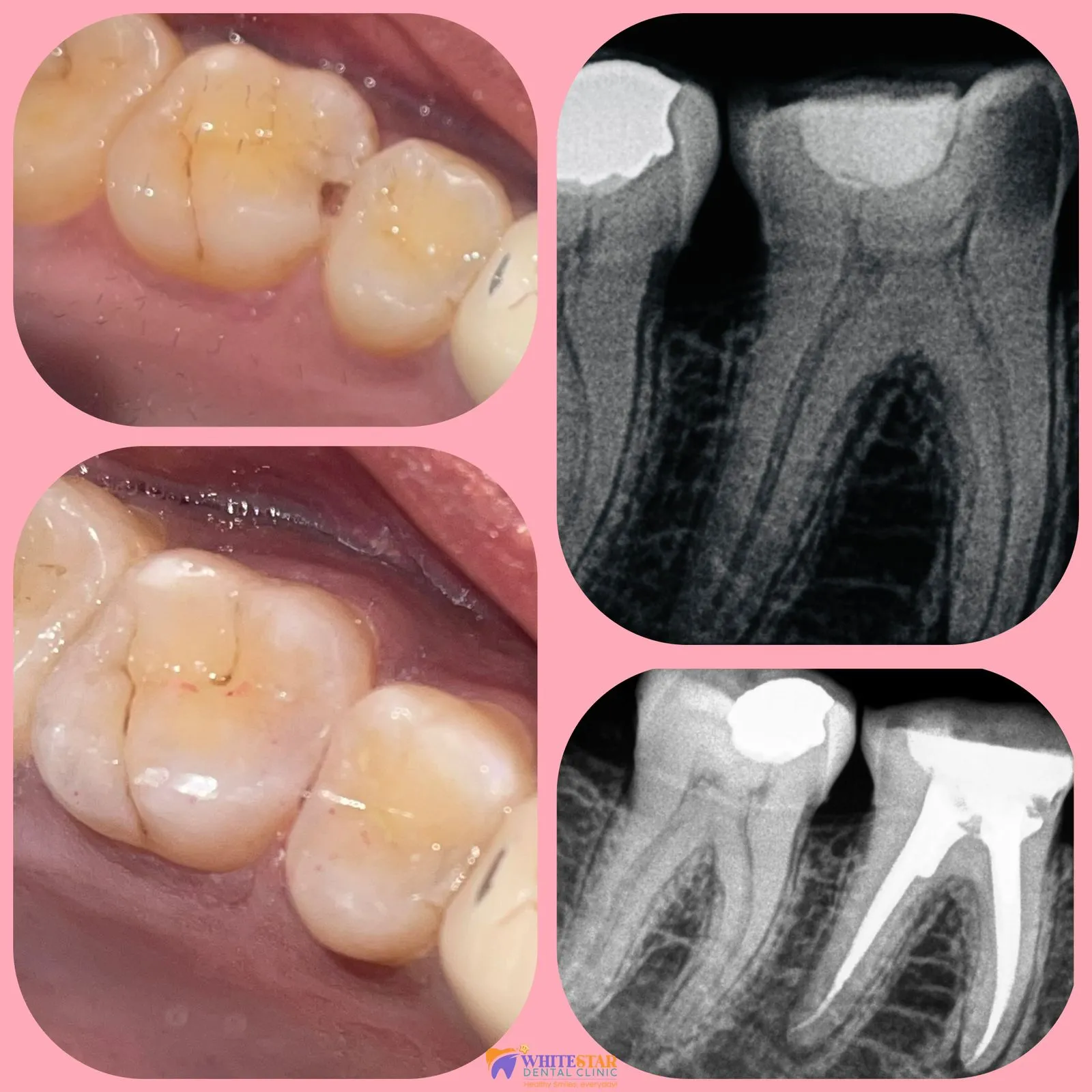 article-1