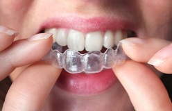Dentures