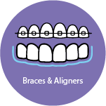Braces and Aligers