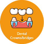 Dental Crown Briges