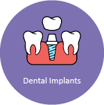 Dental Impants