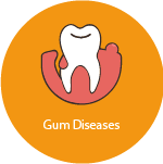 Gum Diseases