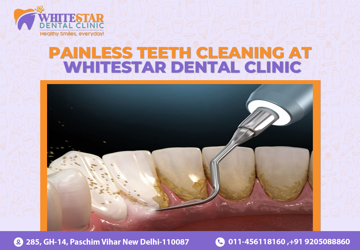Painless-Teeth-Cleaning-at-WhiteStar-Dental-Clinic.